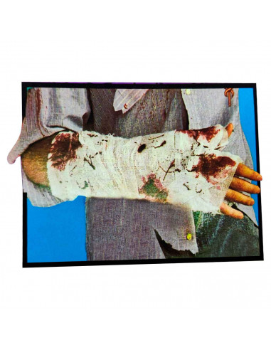 Tradineur - Clásico vendaje ensangrentado para Halloween - Apto para niños y adultos - Ideal para combinar con disfraces para fi