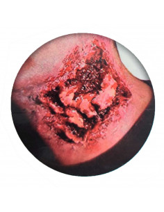 Tradineur - Cicatriz postiza de mordida en el cuello - Diseño realista - Ideal como complemento para disfraces, carnaval, Hallow